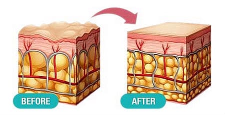 Miracle Phytoceramides - How it Works